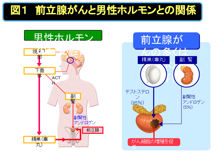 前立腺がんの診断 | 大阪腎泌尿器疾患研究財団